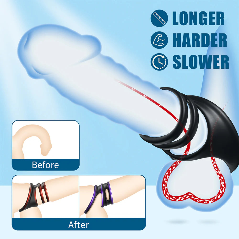 Penis Rings Male Sex Toy - Silicone Cock Rings with 2 Different Style Set for Erectile Enhancement - AVYXO